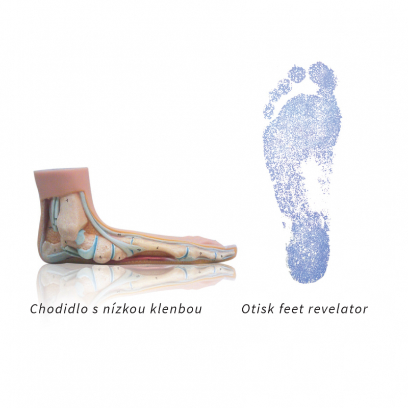 Przybory ortopedyczne Sidas 3Feet Outdoor Low