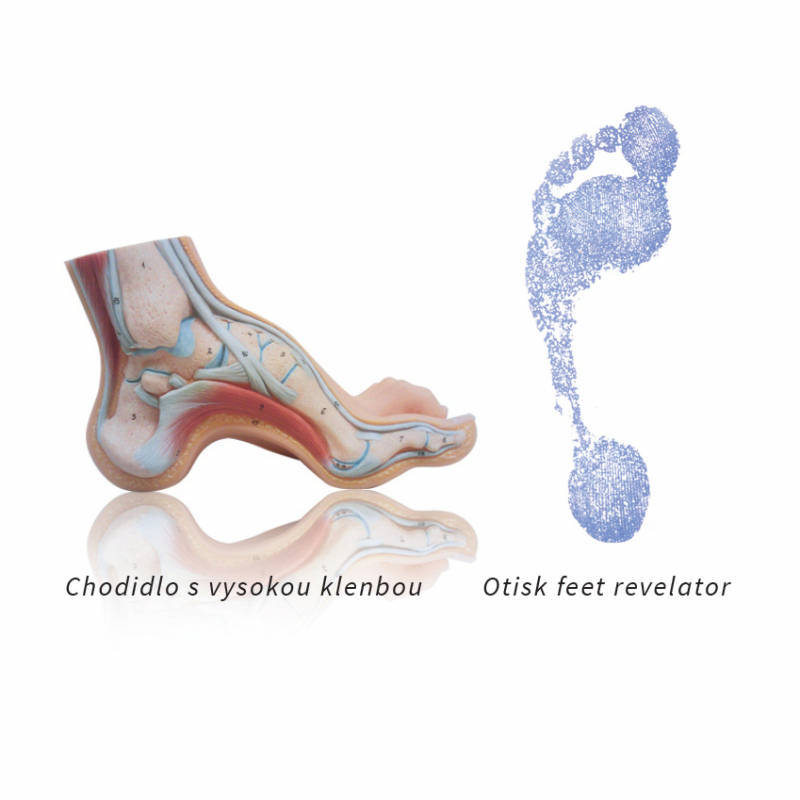 Przybory ortopedyczne Sidas 3Feet Comfort CZ High